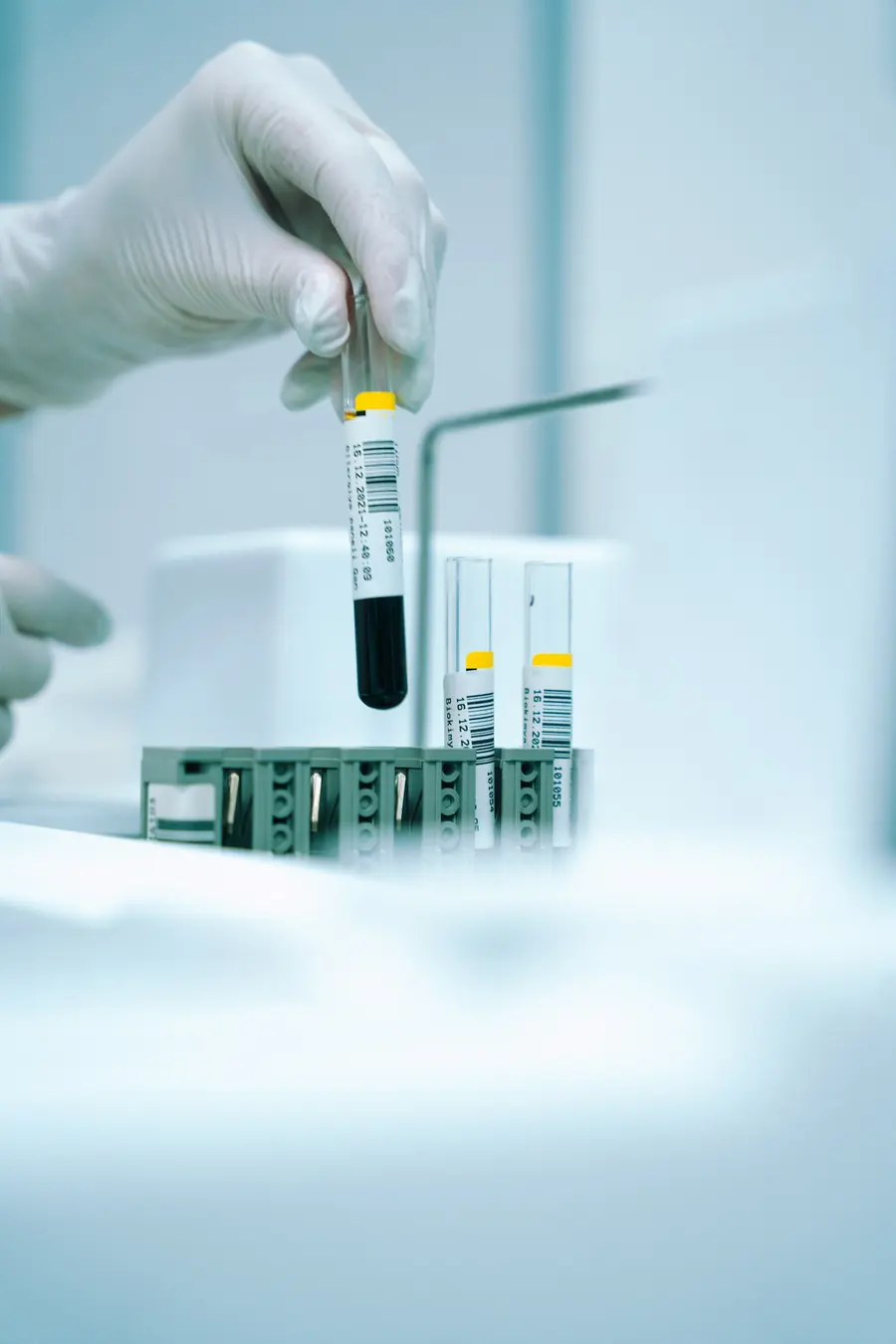 Análisis de sangre en laboratorio para hematooncología