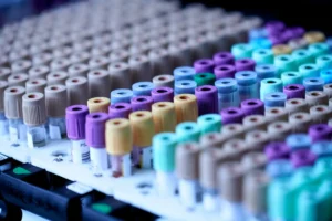 Tubos de muestras de sangre para estudios de hematooncología